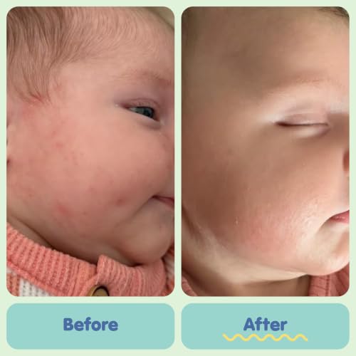 Tubby Todd All Over Ointment, Baby Eczema Cream for Sensitive Skin | Multi-Purpose Baby Skin Relief Cream for Dry Skin, Steroid & Gluten Free, 8 oz,1 Pack, Fragrance Free