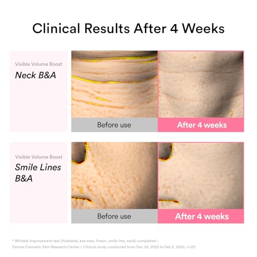 Abib PDRN Volume fill-it Booster Cream 2.5 tube | Facial Volume Plumping with PDRN 15,000ppm Peptides Retinal | For Forehead, Smile Lines & Neck Wrinkles | Anti-Aging Firming | 1.01 fl oz