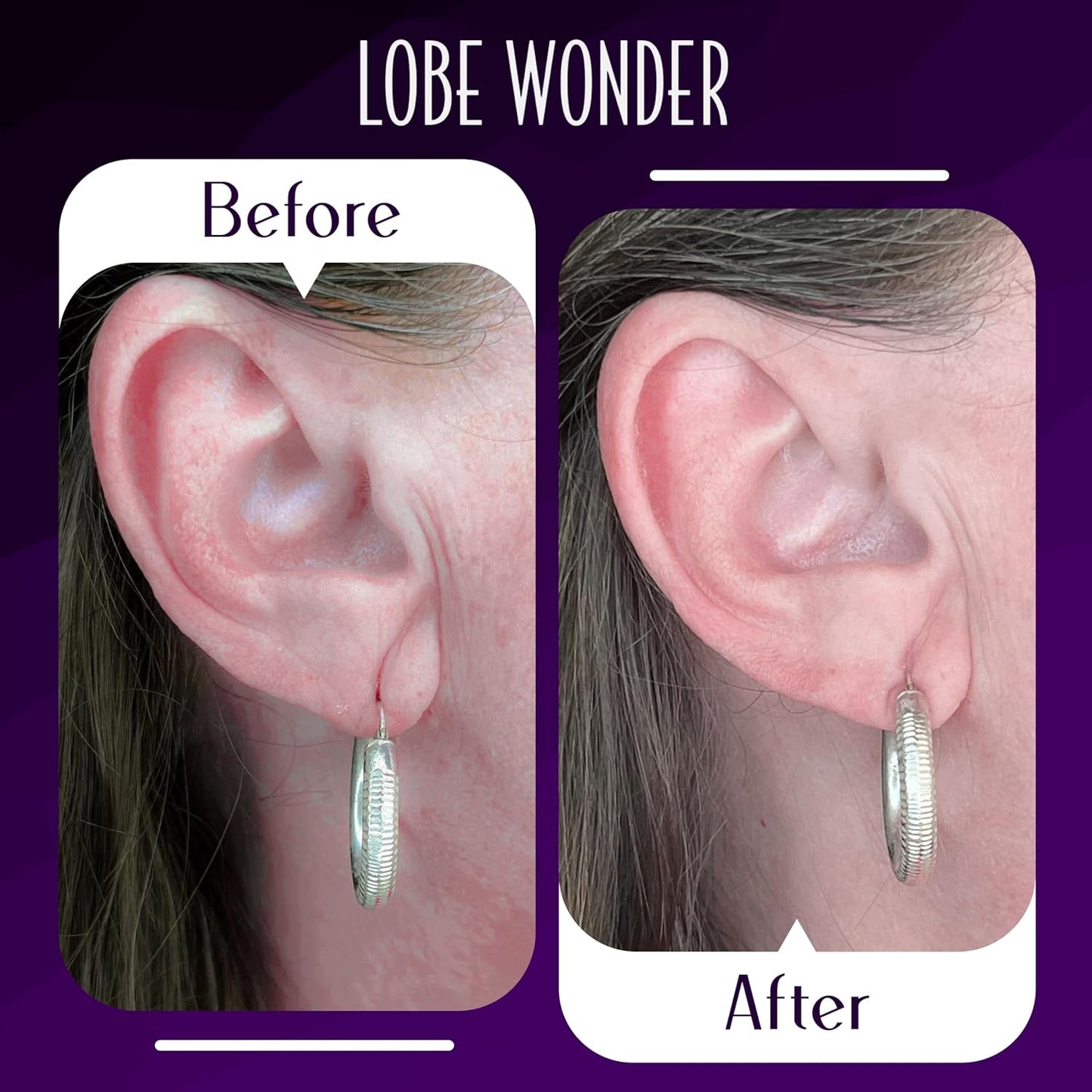 Lobe Wonder - The ORIGINAL Ear Lobe Support Patch for Pierced Ears - Eliminates the Look of Torn or Stretched Piercings - Protects Healthy Ear Lobes from Tearing - 60 Patches - Clear & Latex-Free
